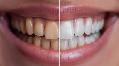 Common Myths About Teeth Whitening