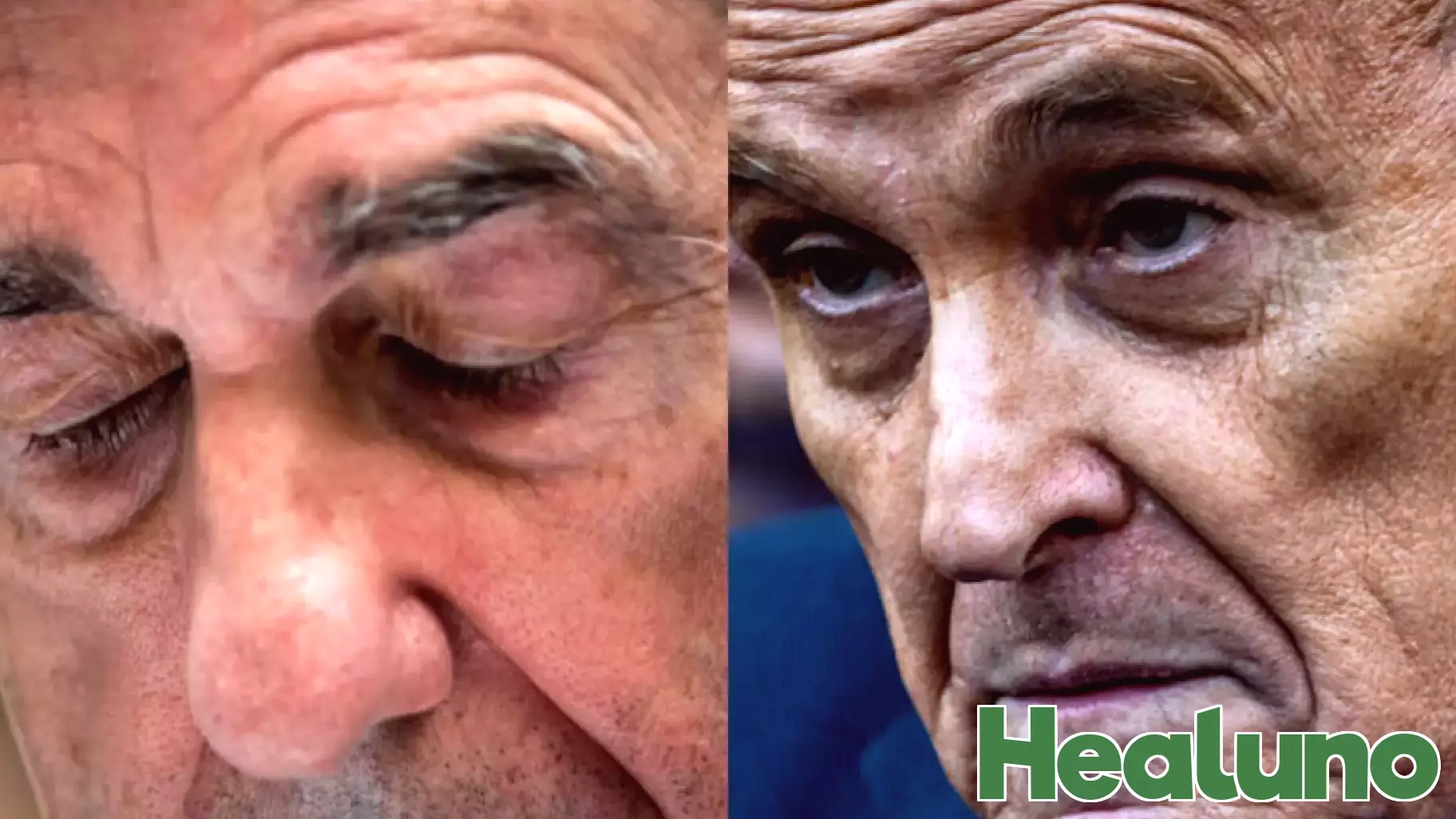 Health Concerns for Giuliani and Mueller