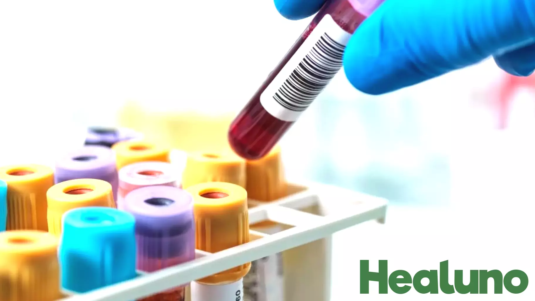 New cholesterol guidelines released by the American Heart Association