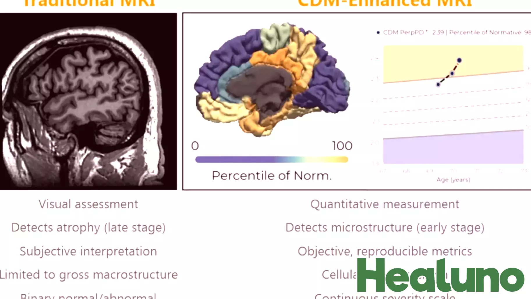 Oxford Brain Diagnostics Showcases Five New Studies on Brain Health Measurement at AAIC 2026