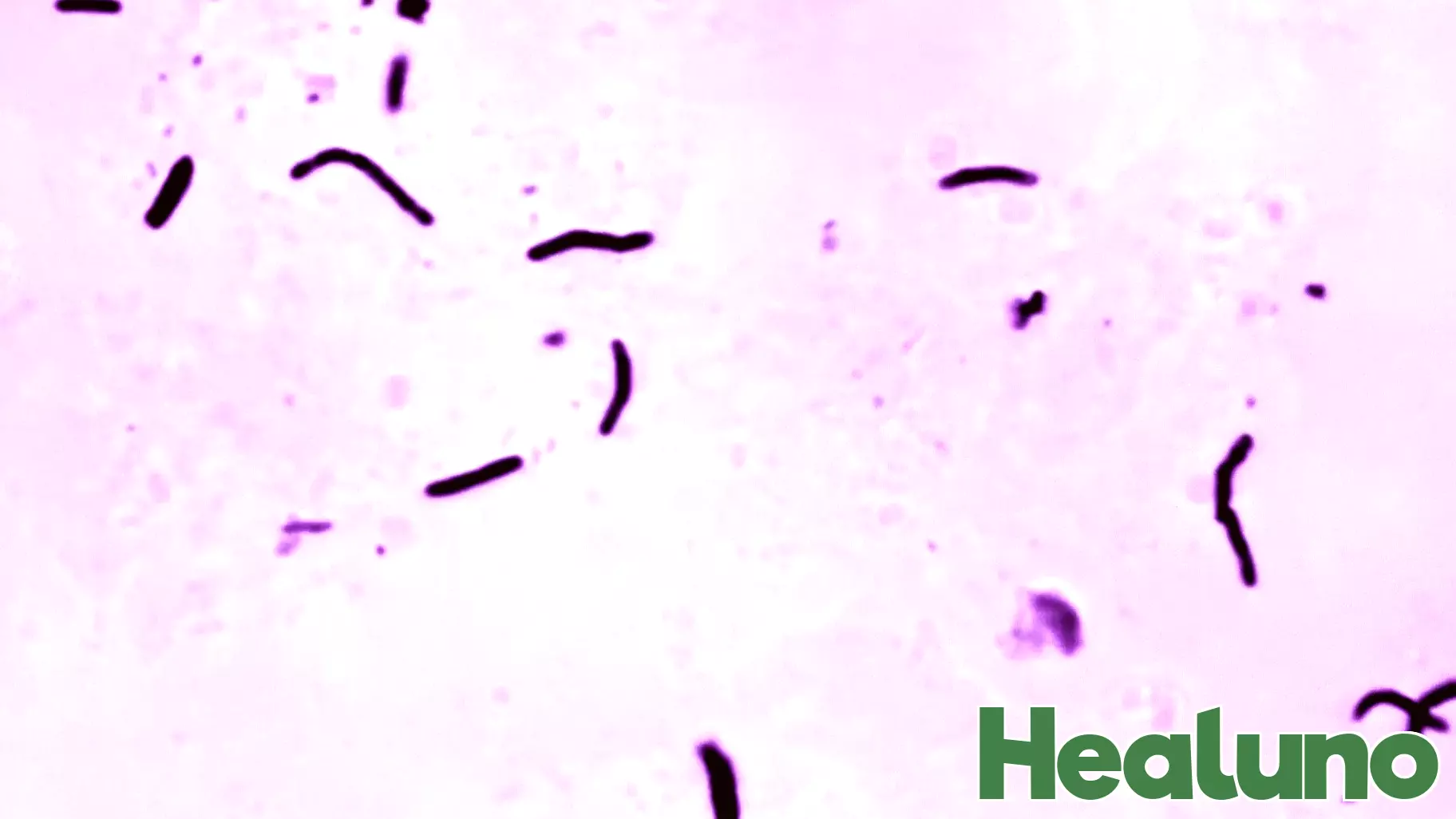 UN Health Agency Warns of Setbacks in Tuberculosis Fight Amid Aid Shortfall