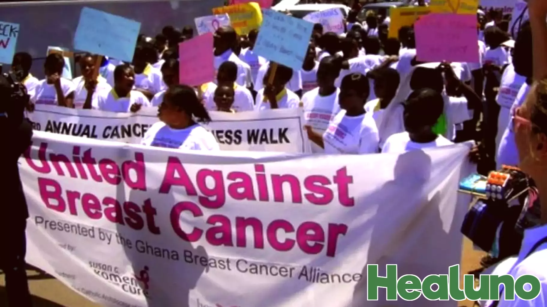 Understanding Breast Cancer: Key Insights from WHO