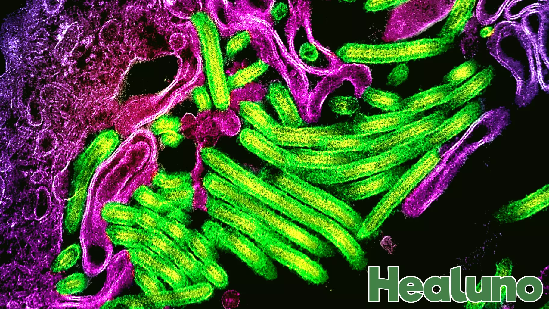 Urgent Response to Ebola Outbreak in DRC’s Kasai Province