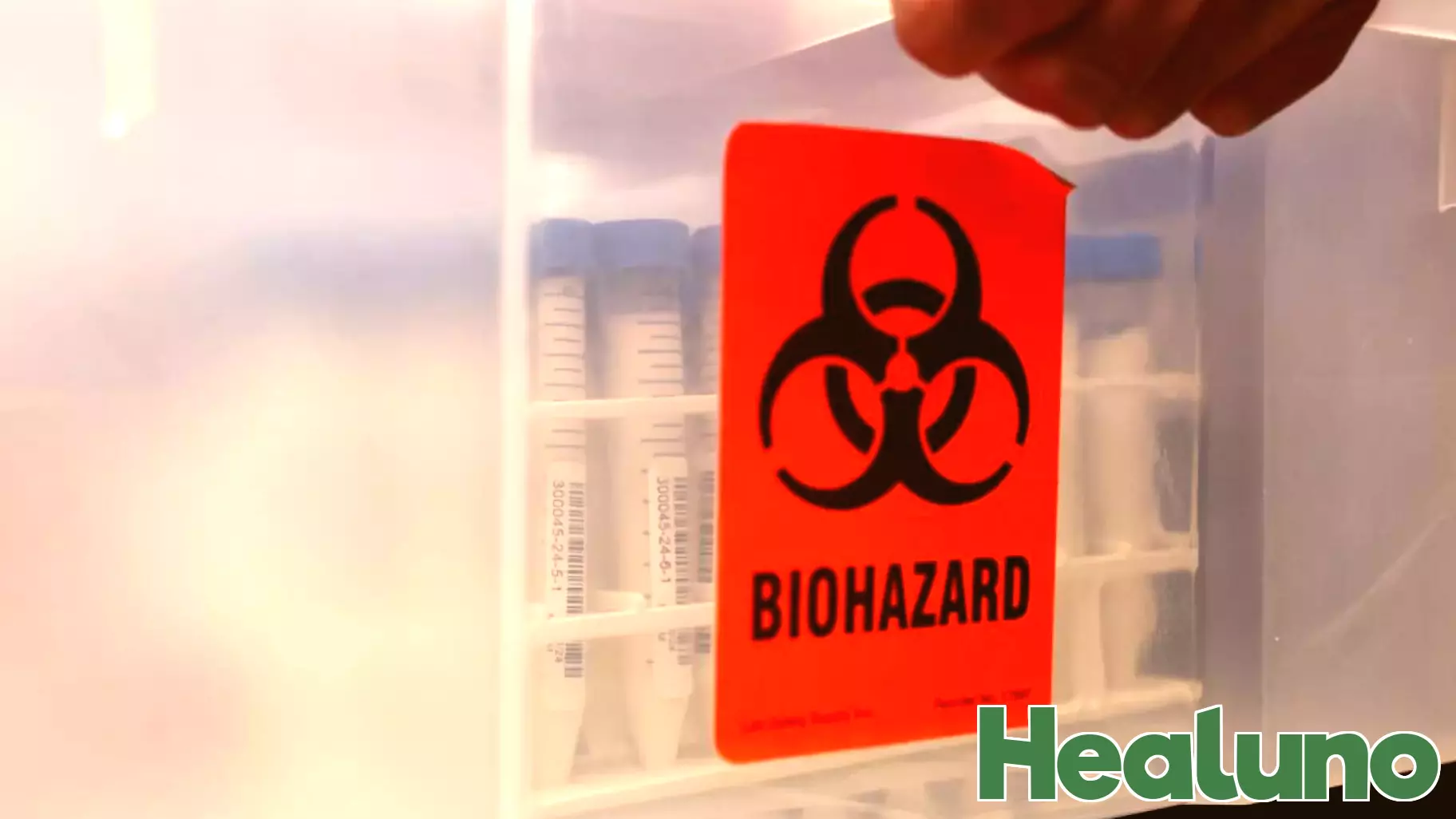 Washington Resident Hospitalized with Presumed Bird Flu Infection