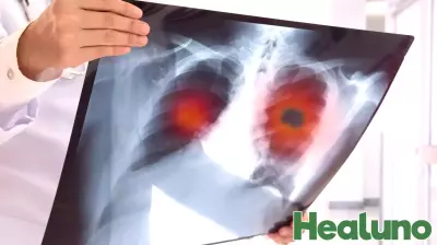 Early Indicators of Lung Cancer: What You Should Know