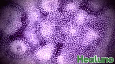 Eighth child in Mass. dies from flu