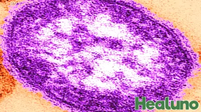 Health officials confirm Marathon County measles case linked to out-of-state travel