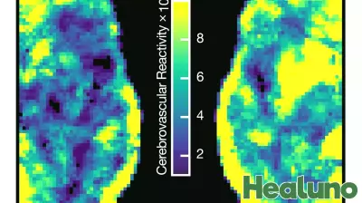 Innovative fMRI Analysis Reveals Surprising Brain Health Benefits in Older Women