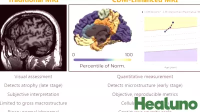 Oxford Brain Diagnostics Showcases Five New Studies on Brain Health Measurement at AAIC 2026