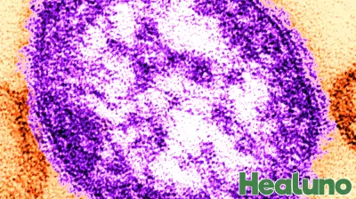 Philadelphia Reports Second Measles Case This Year