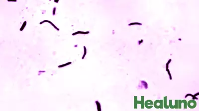 UN Health Agency Warns of Setbacks in Tuberculosis Fight Amid Aid Shortfall