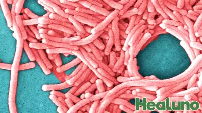 Upper West Side building residents told legionella found in hot water system