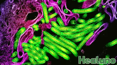 Urgent Response to Ebola Outbreak in DRC’s Kasai Province